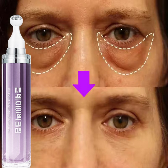 주름개선 아이크림 레티놀 리프팅 아이백 크림 20/30/40/50대여성 아이크림추천 콜라겐 병풀 900샷 아이크림 눈 밑 지방 볼륨 개선 히알루론산 여성 아이크림 추천 60대, 2개, 20ml