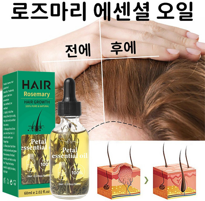 로즈마리 두피 오일 두피에센스 로즈마리 두피 헤어오일 탈모앰플 헤어에센스오일 두피 마사지 오일 100% 탈모에센스, 2개, 60ml