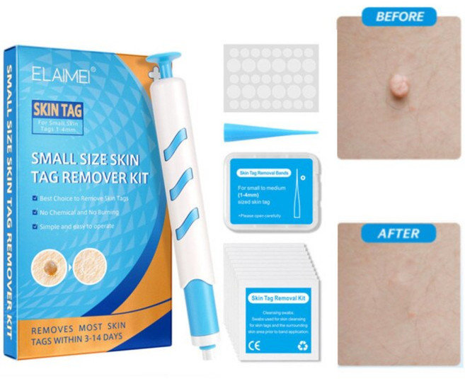 9 Types Skin Label Removal Kit Removing Wart Corn-stick 1-9mm Rubber Ring Removing Mole Device Skin, 10 5-blue