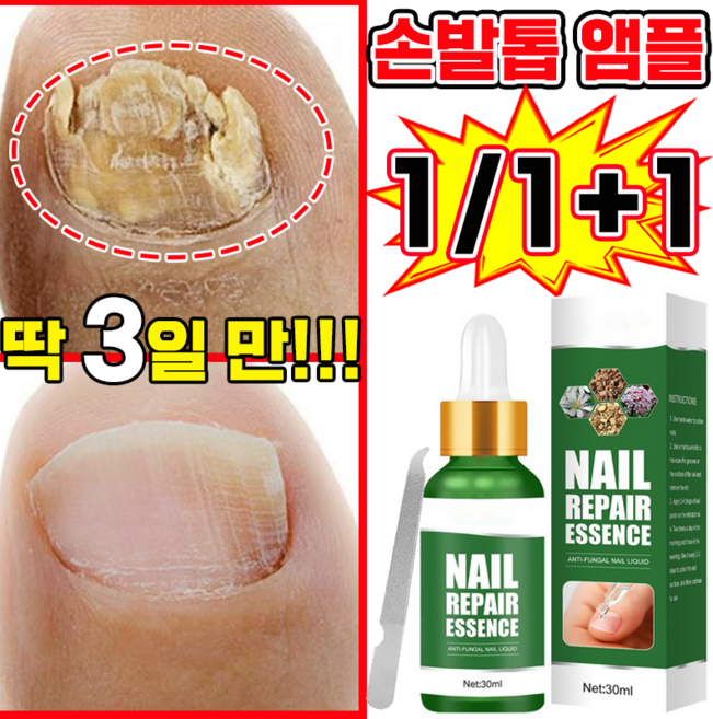 발톱 앰플 솔루션 문제성발톱 영양제 발톱 공팡이 한번에끝내는 손발톱 연화제, 1개, 30ml