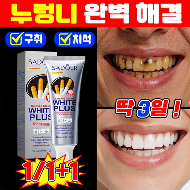 [미국기술] 치아 미백 추천 1 위 미백치약 화이트닝 치약 누렁니 구취 치석 입냄새 제거 충치예방 sadoer, 1개, 100g - 쿠팡