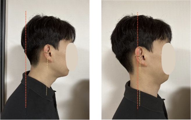 거북목귀걸이 거북목교정운동 드롭귀걸이 골드 2개 세트