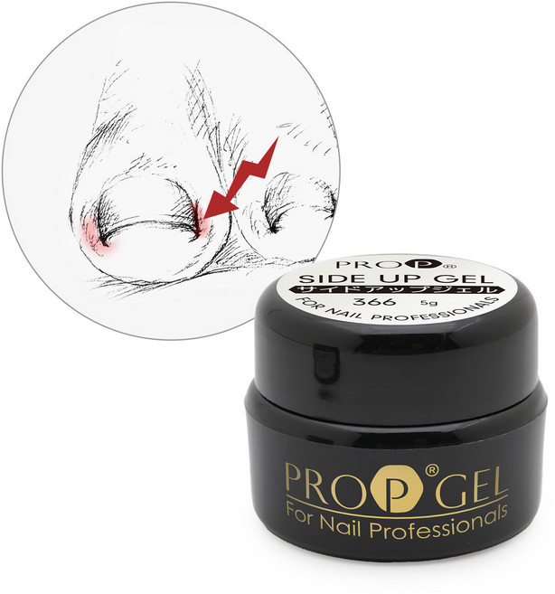 프로프 아오이로 내성손발톱 사이드업젤 아프게 감겨든 손발톱을 펴주는 업젤, 미키리키프로프 내성손발톱을 펴주는 사이드업젤 [1통입], 5g, 1개