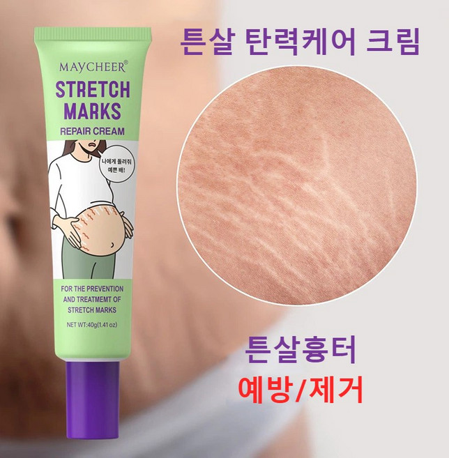CAICHEN 튼살제거 임산부 전용 출산 후 뱃살 탱탱 튼살 완화 크림 흉터 비만 주름 탄력 케어 크림 바디케어, 3개, 40g