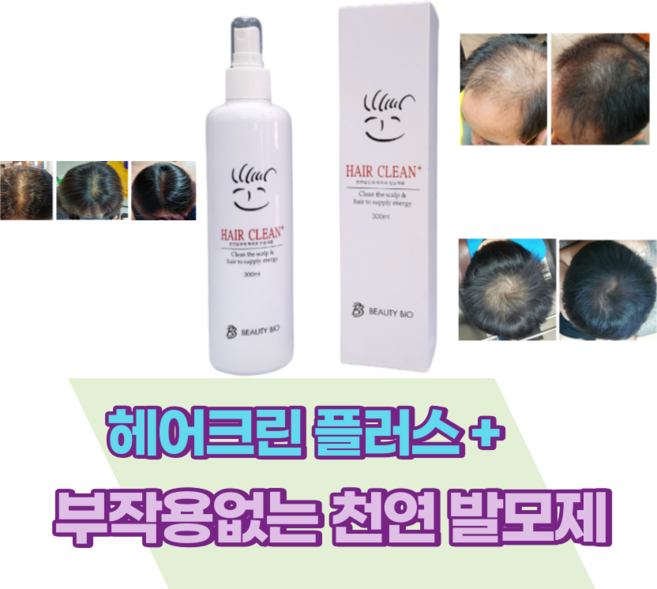 헤어크린플러스 300 부작용 없는 천연발모 탈모방지 발모촉진 원형탈모 M자탈모 완화, 6개, 300ml