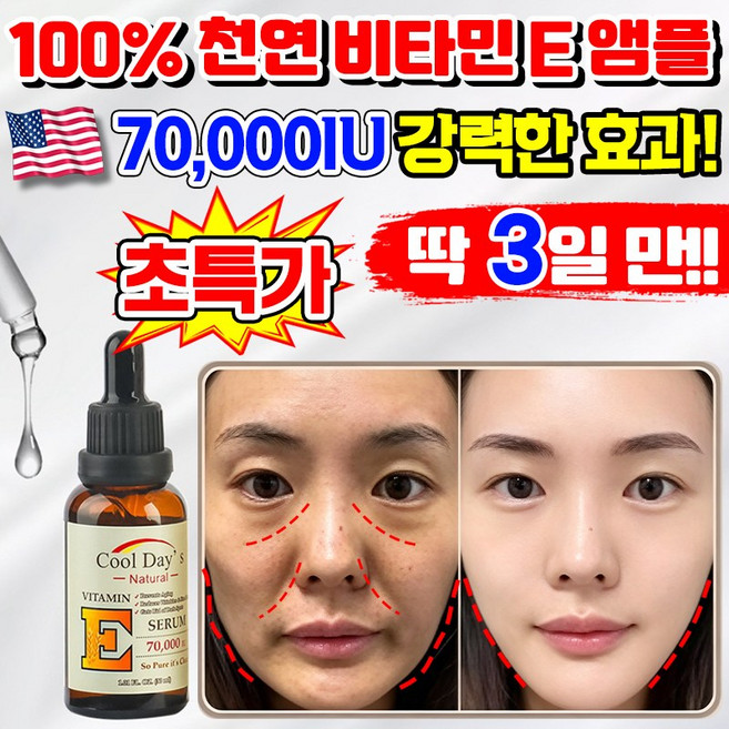[효과보증] 비타민 E 앰플 천연 안티에이징 페이스 오일 얼굴용 모공 수분 미백 세럼 주름 개선 기미 피부 재생 탄력 진정 에센스 얼굴 스킨 케어 화장품 추천 LUPEIYA, 1개, 30ml