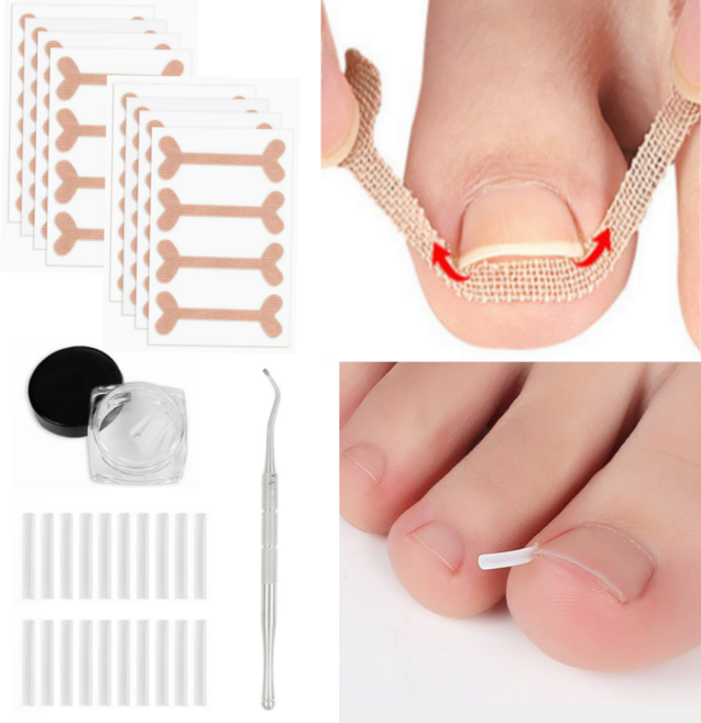 페어토 파고드는 발톱 관리용품 셀프 케어, 1개