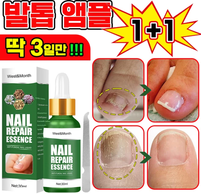 [국내배송] 발톱 거품나는앰플 솔루션 문제성발톱 앰플 발톱 곰팡이 한번에끝내는 손발톱 영양제 보장증정, 2개, 30ml - 쿠팡