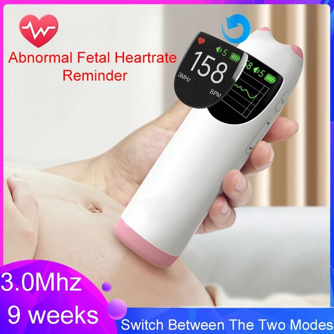 태아심음측정기 태아도플러 점퍼 초음파 임신 모니터 곡선 듀얼 모드 고감도 TFT 스크린 30Mhz, 1개