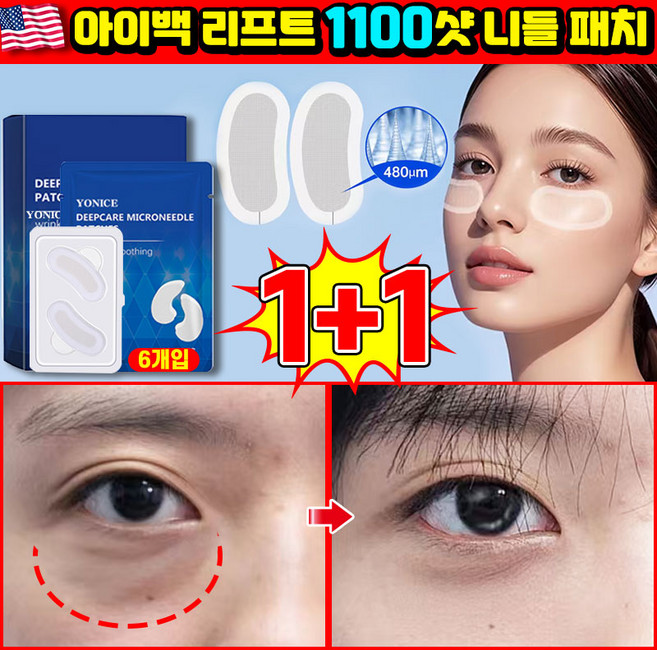 [피부과 추천] 미국기술 아이백 리프트 1100샷 리들 패치 눈밑 지방제거 아이 패치 히알루론산 눈가주름 패치 리프팅 니들패치 브라이티닝 LUPEIYA, 2개, 6개입