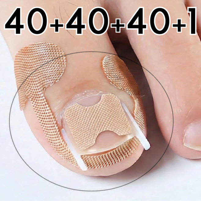 리치봄 파고드는 발톱 관리 테이프 밴드, 1세트