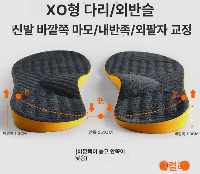 로앤희 오자다리교정기 고정 휜다리 오다리 교정기, 2켤레 32-34 외부 외부높음내부낮음, 1개