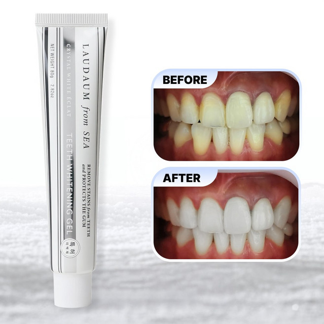 [치약형 강력 미백제] 로다움 착색 제거 고함량 셀프 화이트닝 치아 미백치약 (편백향)