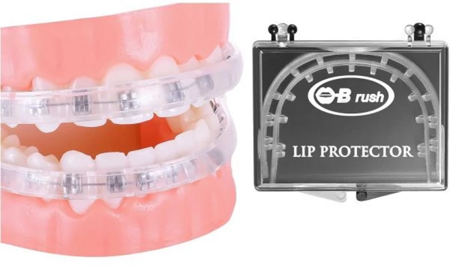교정용 컴포트 커버 - 교정용 마우스 가드 립 프로텍터 왁스 대체제 브래킷용 립 쉴드, 1개 - 쿠팡