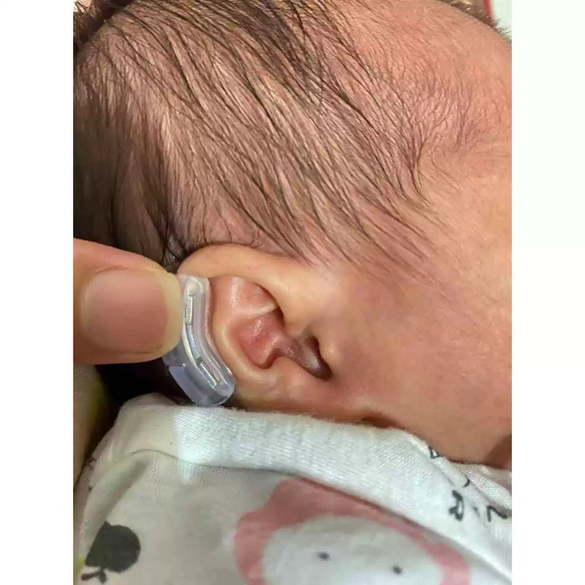 신생아귀교정귀교정스티커 방수 테이프 1개, 왼쪽 귀 프리미엄 3단 클립, 기본 색상