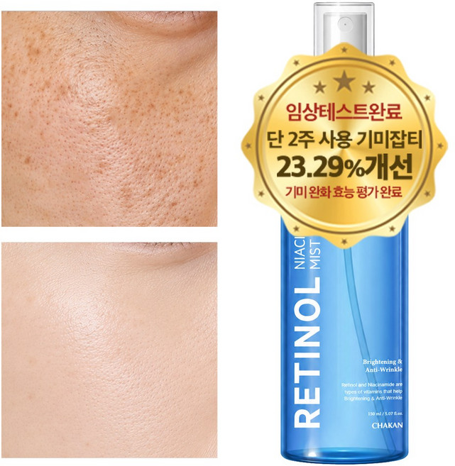 레티놀 나이아신아마이드 기미잡티 미백 미스트세럼 색소침착 수분 광채, 1개, 150ml