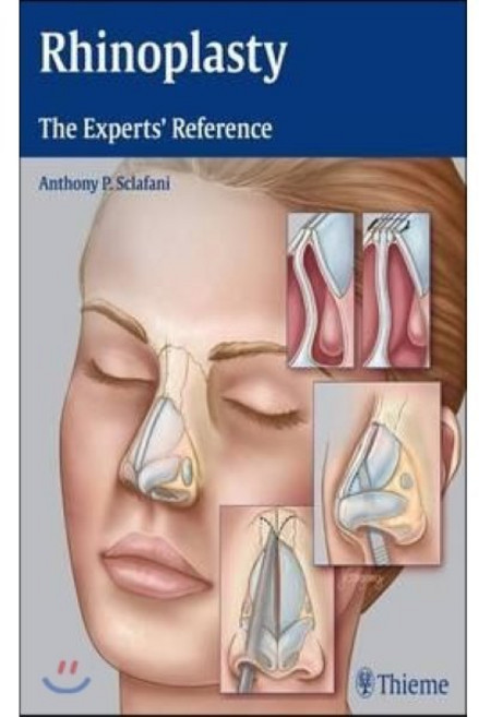 Rhinoplasty : The Experts' Reference, Thieme Medical Publishers