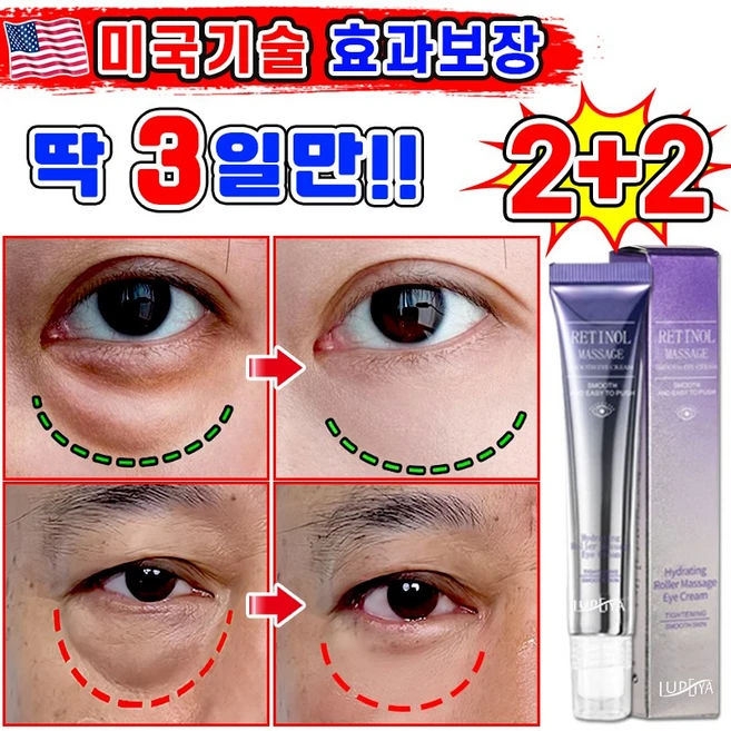 [효과보장] 1/1+1/2+2 아이백 리프팅 900샷 아이크림 눈 밑 지방 볼륨 개선 눈밑지방 제거 아이백 크림 다크서클 눈밑꺼짐 제거 아이케어 LUPEIYA 포장증정, 4개, 20g - 쿠팡