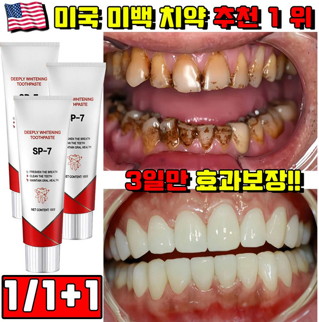 1/1+1 미백 치약 추천 1 위 누렁니 미백 치약 고불소 치약 입냄새 제거 화이트닝 구취제거 불소 치약 잇몸 자생 영양제 미국 SP7치약 YAYASHI 사은품 랜덤 증정, 100g, 1개