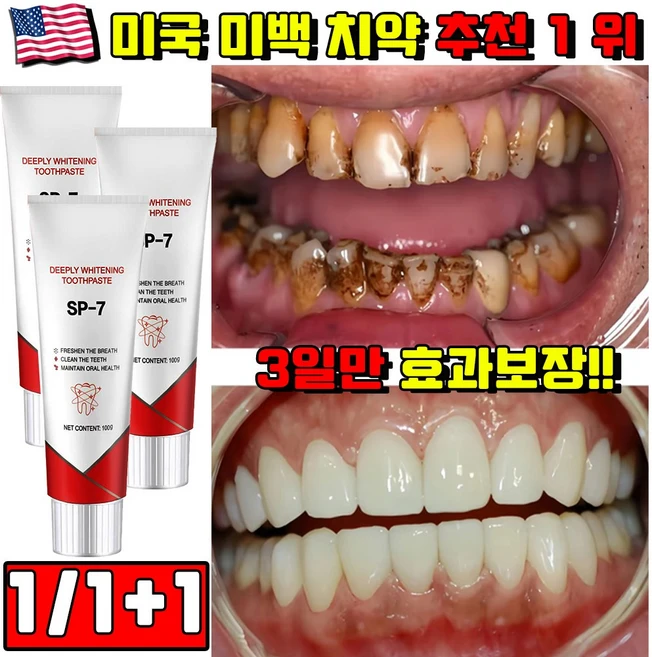1/1+1 미백 치약 추천 1 위 누렁니 미백 치약 고불소 치약 입냄새 제거 화이트닝 구취제거 불소 치약 잇몸 자생 영양제 미국 SP7치약 YAYASHI 사은품 랜덤 증정, 100g, 1개 - 쿠팡