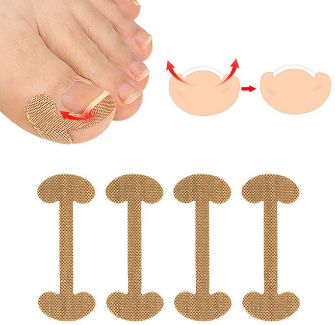 내성 발톱 보호 스티커 테이프 관리 케어 엄지 자가_ 20772956EA, 1