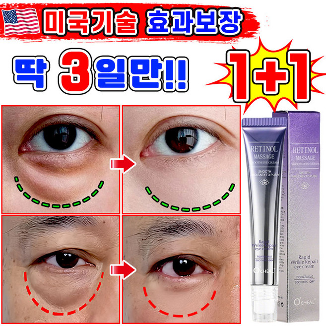 [효과보장] 1/1+1/2+2 아이백 리프팅 900샷 아이크림 눈 밑 지방 볼륨 개선 눈밑지방 제거 아이백 크림 다크서클 눈밑꺼짐 제거 아이케어 LUPEIYA 포장증정, 2개, 20g