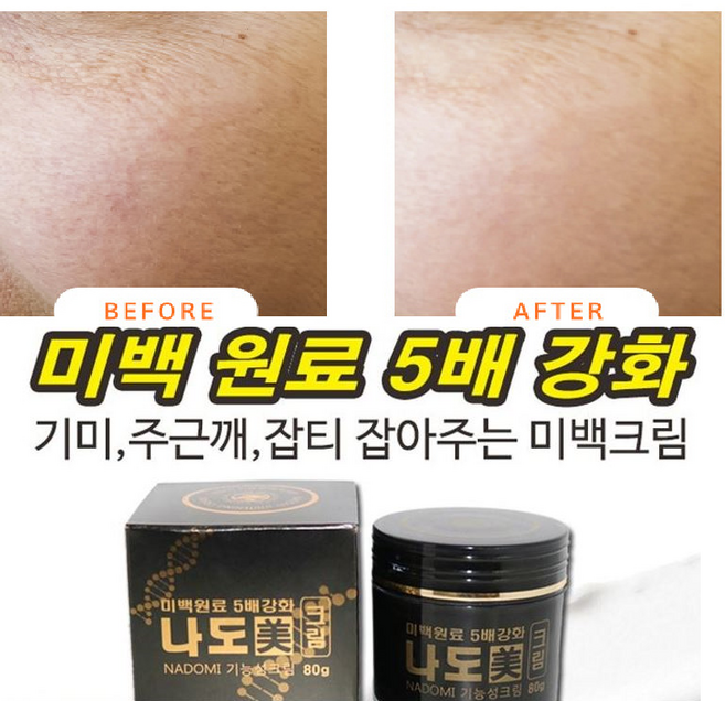 약국용 특허 기미잡티 검버섯크림/기미지우개 검버섯제거연고 검버섯제거크림 검버섯앰플 기능성인증 기미주근깨잡아주는, 1)기미잡티 검버섯제거크림1+1, 2개