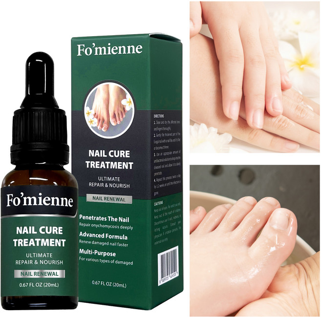 포미엔느 네일 큐어 트리트먼트 문제성 손톱 발톱 솔루션, 1개, 20ml