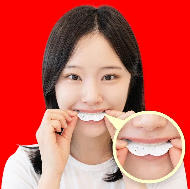 이갈이 마우스피스 방지 가드 수면용 스플린트 수면, 1세트 - 쿠팡