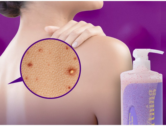 와이트닝 스케일링 토닝 스크럽 워시 300ml / 모공각화 등드름 트러블 필링 각질 바디워시 보습, 1개