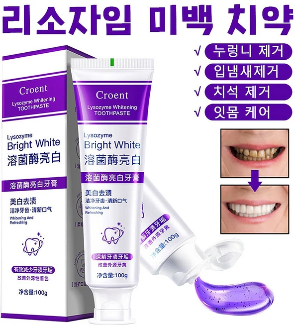보라색 미백치약 입 냄새 제거 치석 제거 잇몸 케어 누렁니 미백 치약 라이소자임 미백 치약, 5개, 100g - 쿠팡