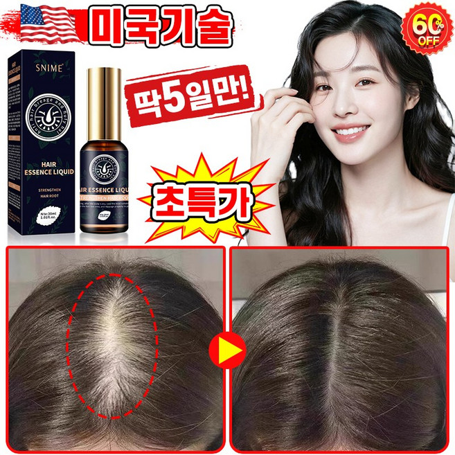 [빠른효과] 미국기술 1/1+1/2+2 두피 영양제 머리 발모제 모발 성장 촉진 에센스 탈모 방지 완화 두피케어 세럼 포장증정, 1개, 30ml