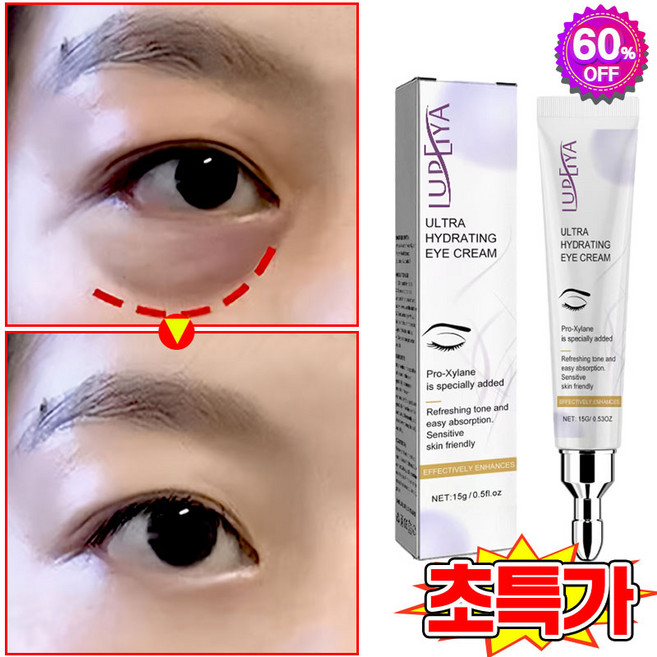 [피부과 추천] 1/1+1/2+2 눈밑지방 아이백 리프팅 아이크림 눈 밑 지방 제거 크림 아이백 크림 다크서클 눈밑꺼짐 제거 눈가 주름개선 LUPEIYA 포장증정, 1개, 15g