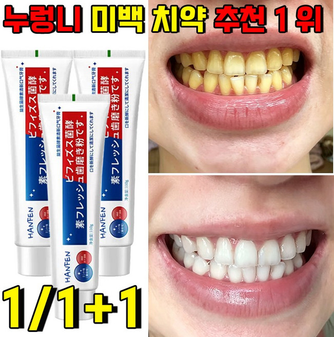 누렁니 미백 치약 추천 1 위 화이트닝 치약 치아 미백 치약 입냄새 제거 110g [매일 10명의 주문 고객님께 사은품 증정], 1개