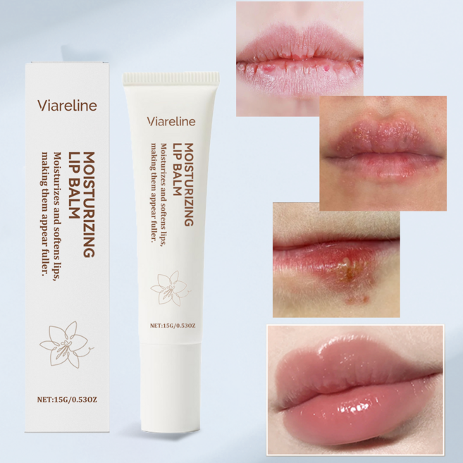 대용량 립에센스 입술포진 헤르페스 구순물집 입술 각질제거 입술 립밤 립케어 전용 각질관리 립크림 입술보습제 립밤에센스 보습 립밤, 1개, 20g, 무색