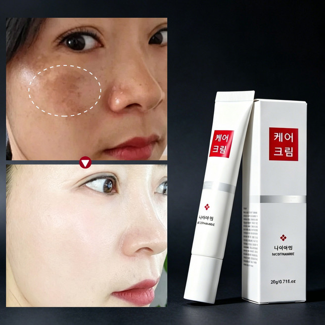 [국내배송/당일출고] 멜라논 크림 | 기미 잡티 집중 케어 | 칙칙한 피부 톤 업 | 톤 업 & 보습 크림, 1개, 20g