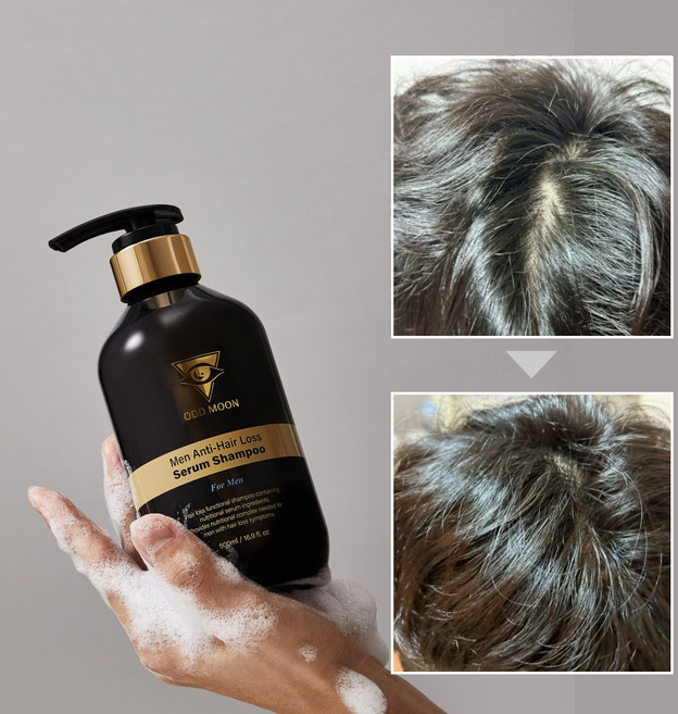 2주 완성 오드문 탈모 세럼 샴푸, 1개, 맨(남성), 500ml