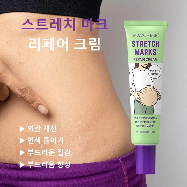 CAICHEN 튼살제거 임산부 전용 출산 후 뱃살 탱탱 튼살 완화 크림 흉터 비만 주름 탄력 케어 크림 바디케어, 5개, 40g