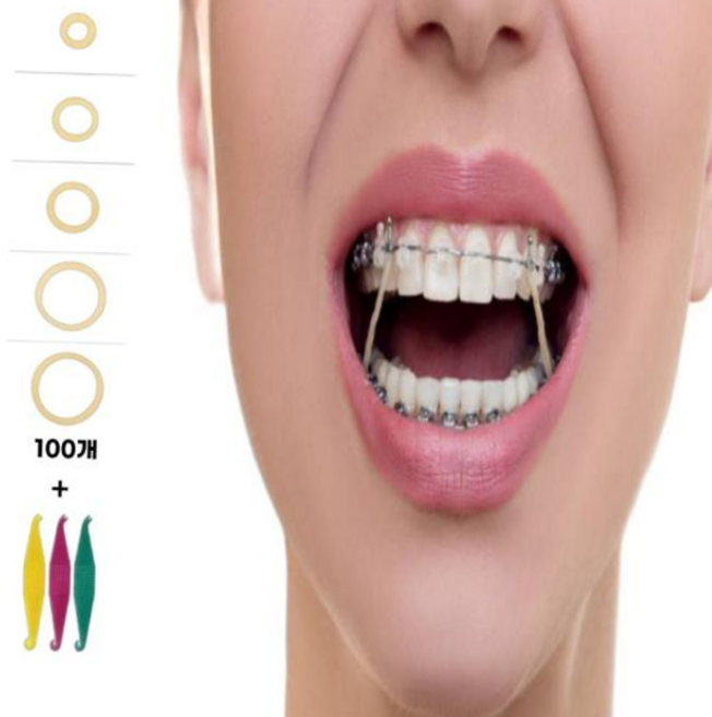루체트리 교정고무줄 착용 5size 100개 치아 셀프 교정기 구강용품