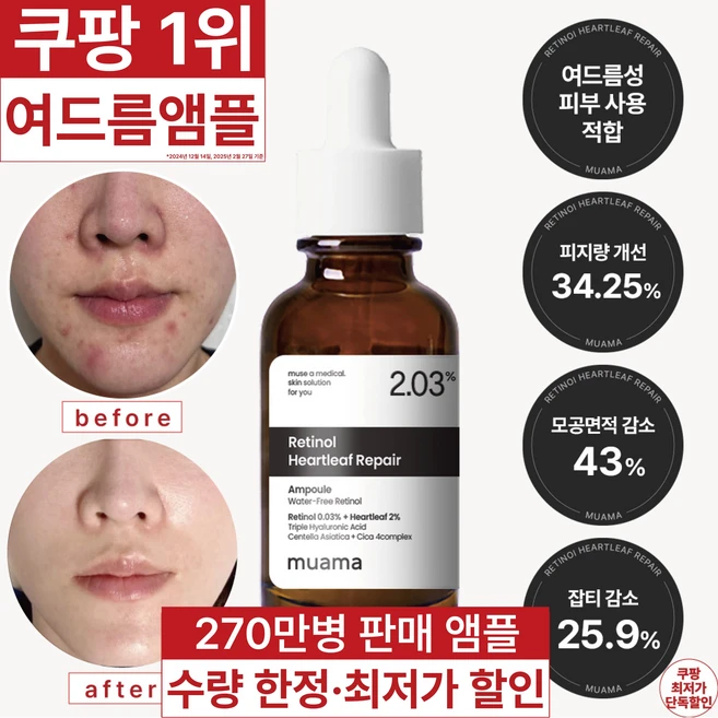 3일 여드름 순삭 진정 모공면적감소 피지감소 임상완료 [270만병 판매기념 할인] 고함량 레티놀 어성초 히알루론산 나이아신아마이드 뮤아마 앰플, 1개, 30ml - 쿠팡