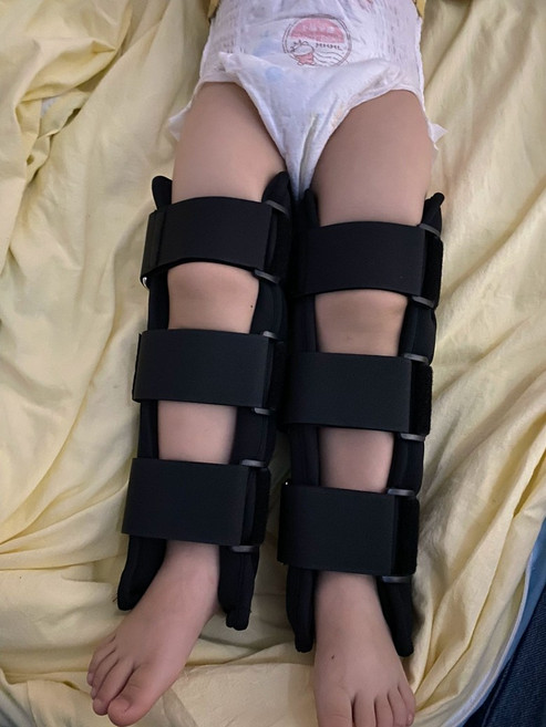 안짱다리 보정기 자세 오자다리 프리사이즈 보조기, 블랙S 신장 83-92CM, 1개