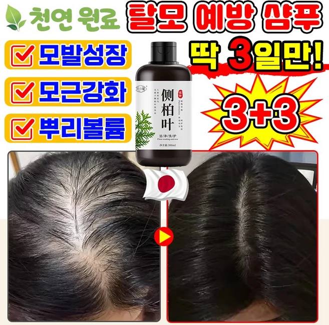 [천연식물추출] 탈모 예방 샴푸 비듬 약산성 지루성 두피 샴푸 두피 손상모 케어 관리 모근 강화 에센스 여성 남자 M자 탈모 완화 모발 성장 영양제, 6개, 300ml - 쿠팡