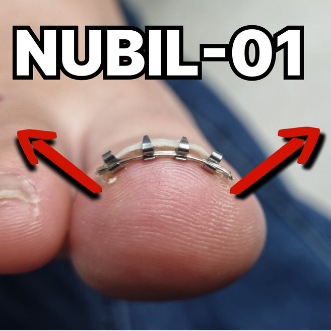 nubil-01 누빌영일 내성발톱 내성발톱교정기 내향성발톱 교정기기 발톱교정 내성발톱케어 교정, 1개