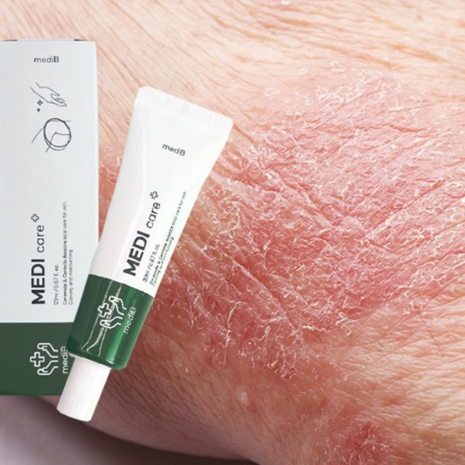 피부장벽 가려움증 연고 아토피용 피부진정 각질케어 크림, 1개