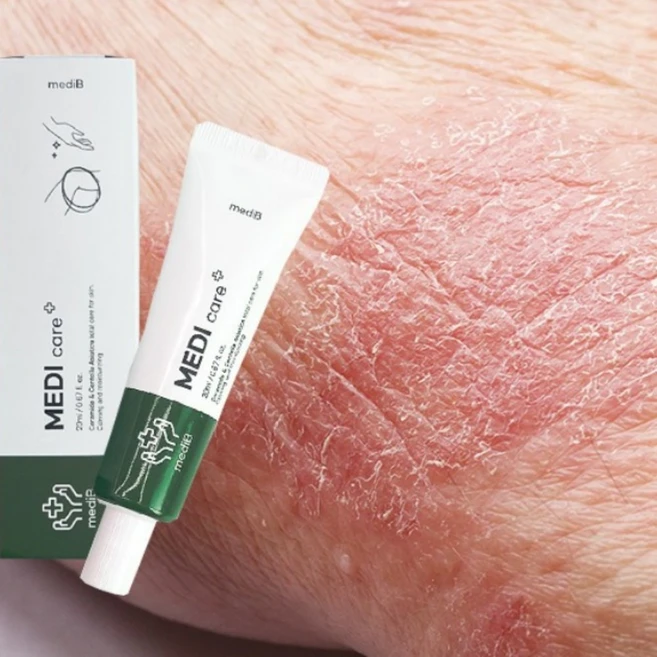 피부장벽 가려움증 연고 아토피용 피부진정 각질케어 크림, 1개 - 쿠팡