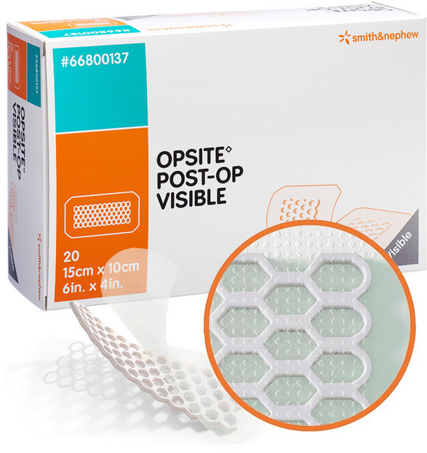 S&N 오피사이트 OPSITE POST-OP VISIBLE 15cm x 10cm 벌집 20개 점착성투명창상피복재, 오피사이트 15cm x10cm, 1박스