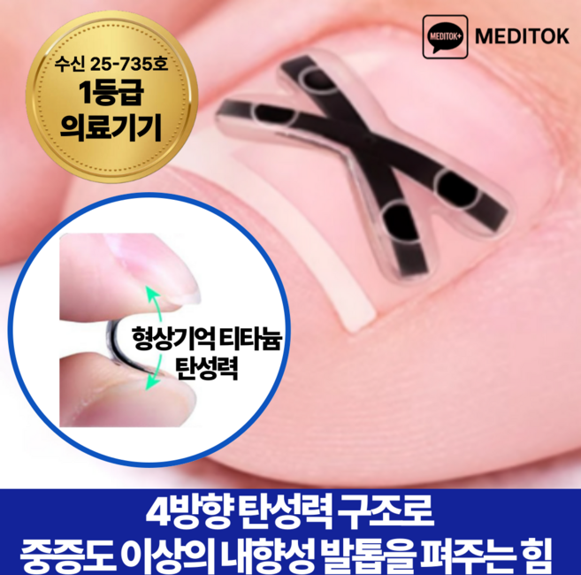 메디톡 티탄토우 더블 티타늄 밴드 교정기 X자형 내성발톱 교정기 교정밴드 티타늄 의료기기 테이프 파고드는 발톱 관리 교정팁, 10개