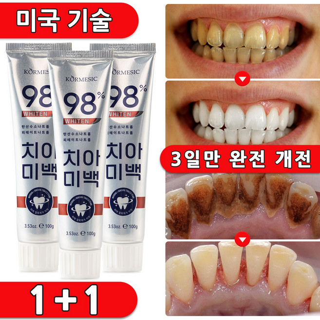 [당일 배송] 치약 휴대용 미백 대한민국 판매1위 치약 추천 1 위 치약 치약 불소치약 추천 1 위, 2개, 100ml