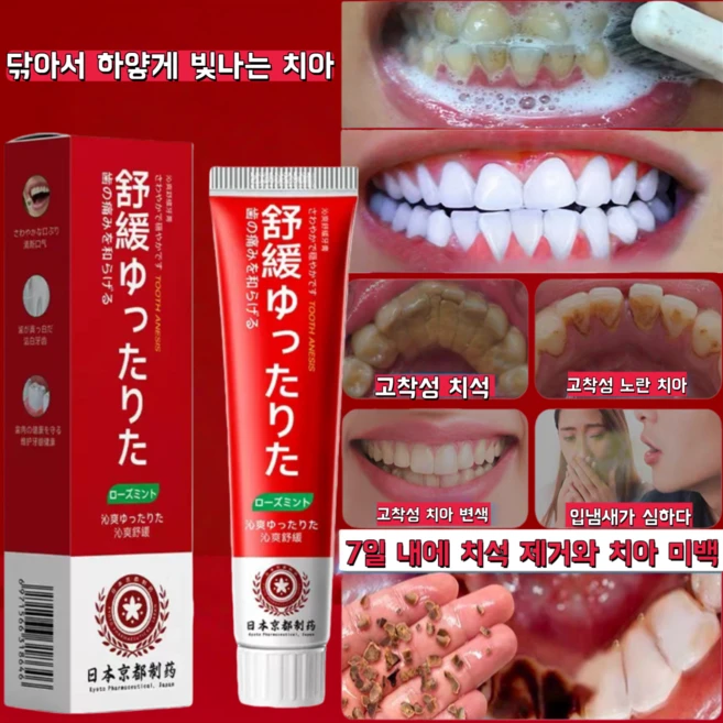 강력 착색 제거 치약 치아 미백 누런 이 검은 이 치석 구취 제거 잇몸 시린이 보호/QQ23, 2개, 100g - 쿠팡