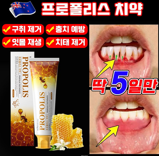 [치약 추천 1위] 프로폴리스 치약 약국 전용 잇몸 치약 플라코 치주염 치약 구내염 치약 구취제거 통증 완화 냄새 제거 포장 증정, 100g, 1개